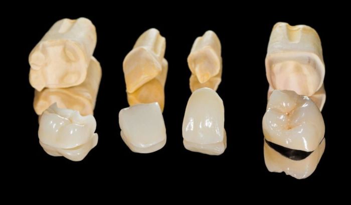 Differentiate between direct and indirect restorative materials